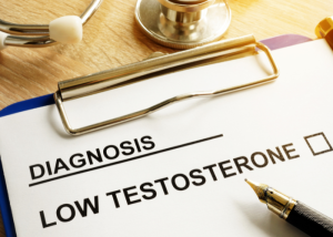 low testosterone levels test