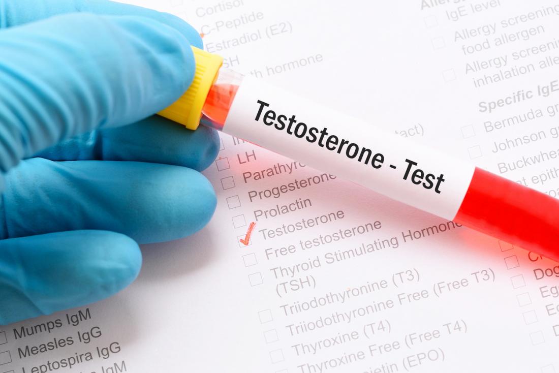 normal-testosterone-blood-test
