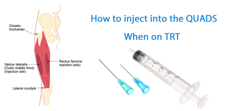 Testosterone Quad Injection Site
