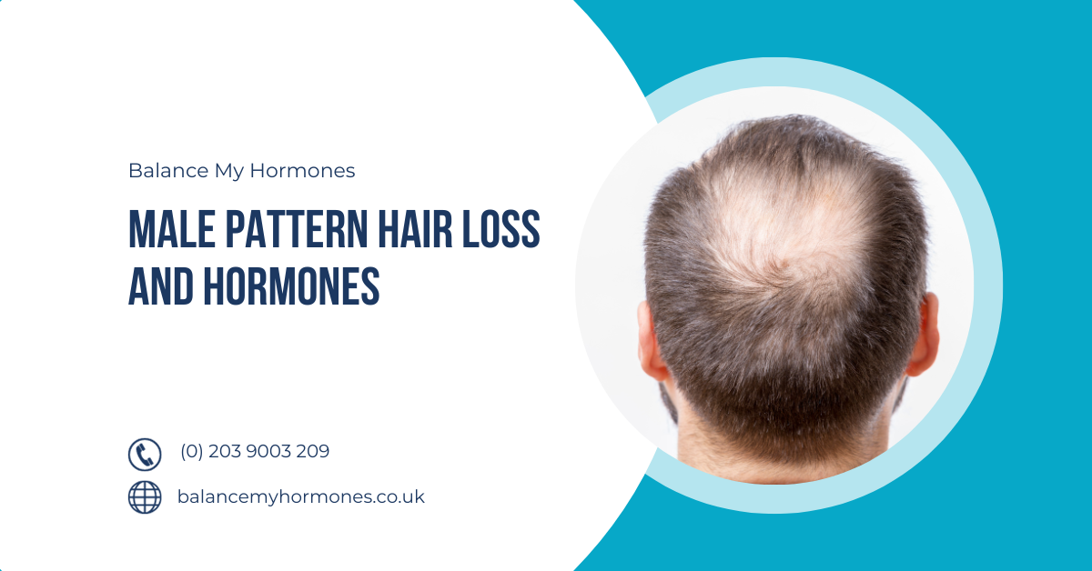 Male Pattern Hair Loss and Hormones