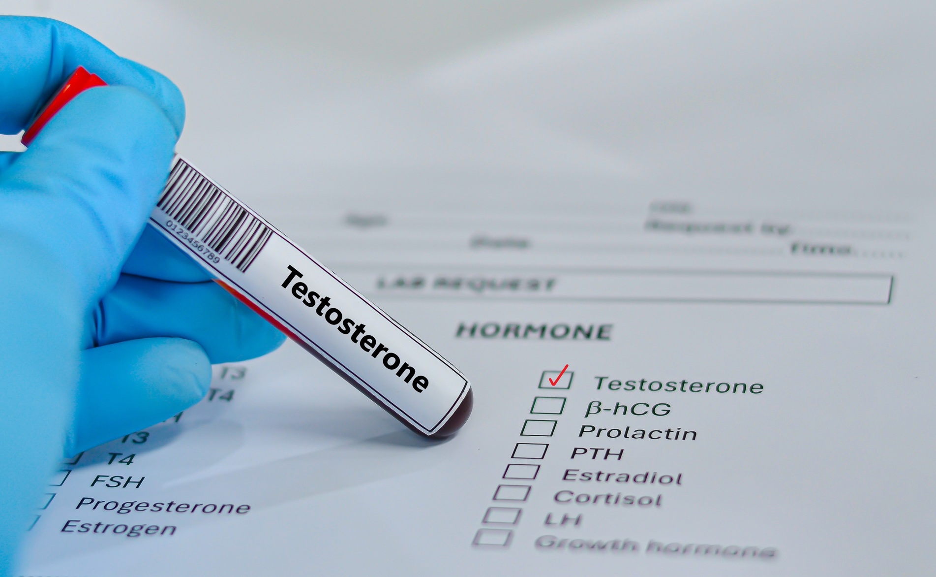 low testosterone treatment